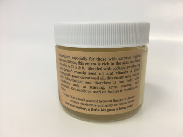 Product image of Eczema Cream