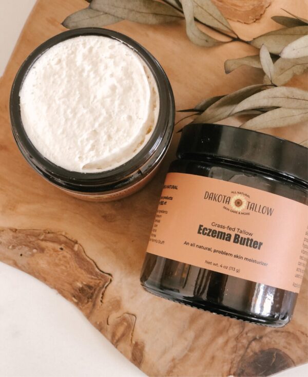 Product image of Eczema Butter